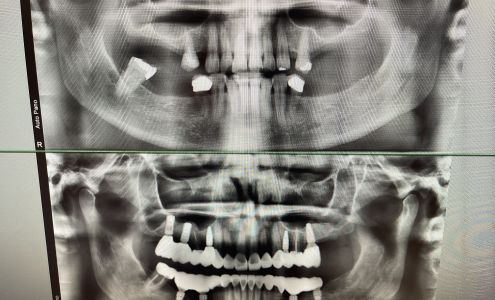 Myrtle Grove Implant and Family Dentistry