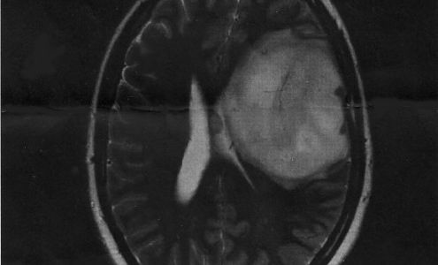 Miller Eye Care & Optical