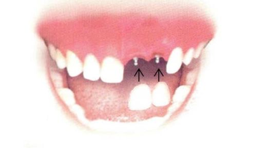 Dr. Ralph L. Pruette, DDS 202 N McDuffie St, Anderson South Carolina 29621