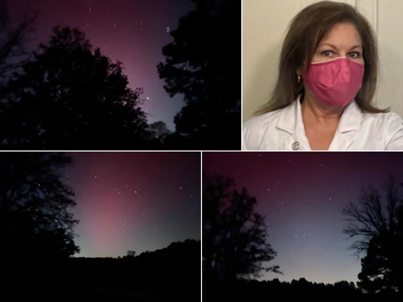 Electrolysis By Ruth Ann Owens, RN