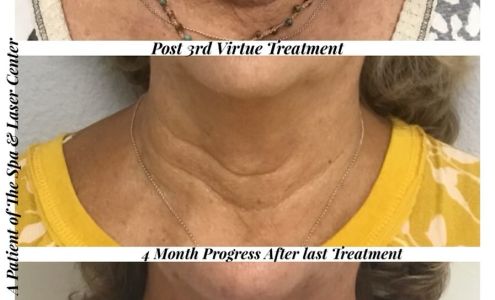 Kate Perino, LME (Spa & Laser Center) 2829 Shore Dr, Virginia Beach Virginia 23451