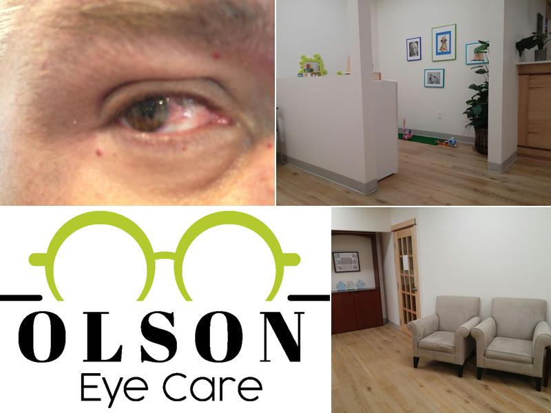 Olson Eye Care