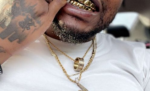Pristine Gold Grillz Melbourne