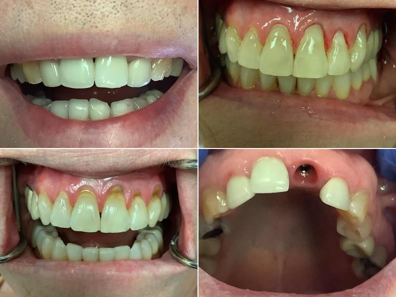 Fine Dentistry For Adults