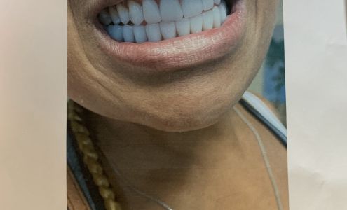 AApoLLo Dental Centers