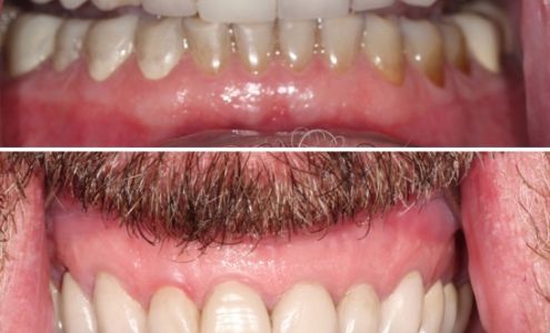 Casas Adobes Dentistry