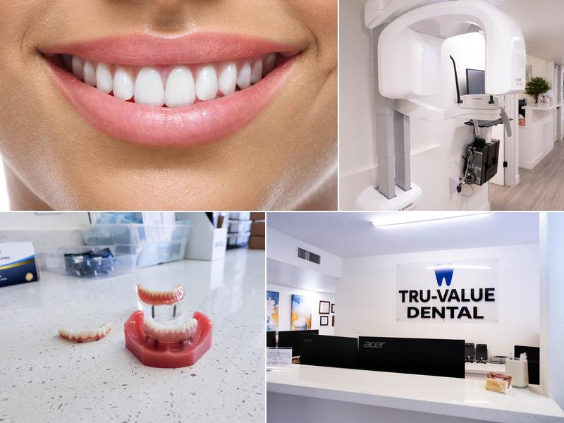 Tru-Value Dental and Denture
