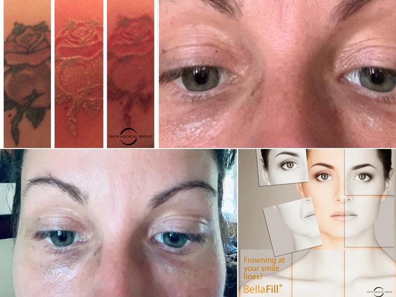 Onyx Medical Aesthetics