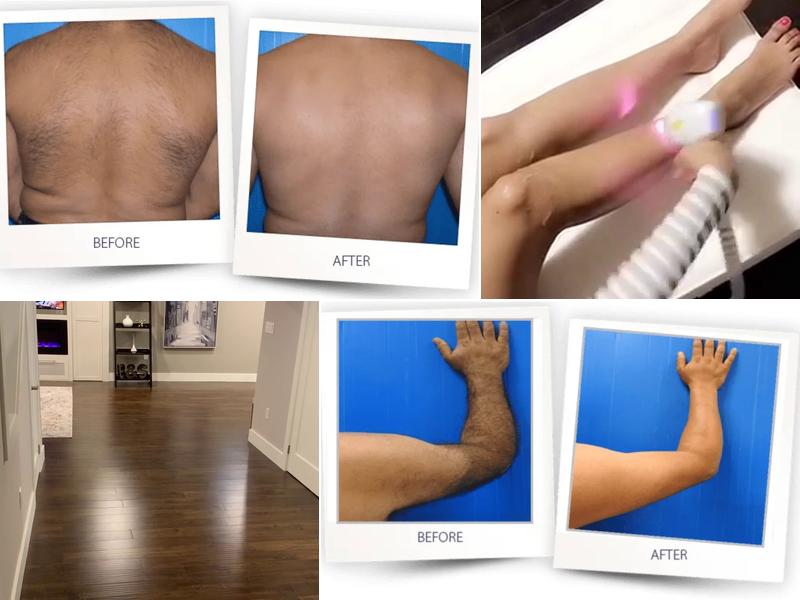 Skin Bar Spa - Laser Hair Removal Mississauga