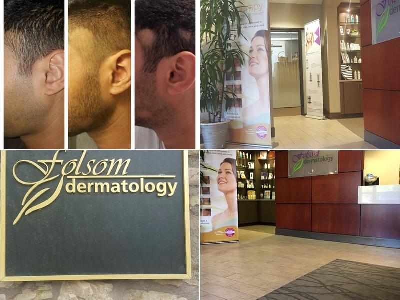 Folsom Dermatology