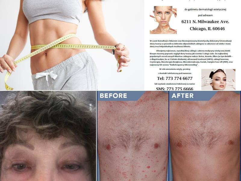 Pediatrics & Dermatology Laser