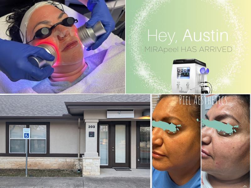 Piel Aesthetics Med Spa