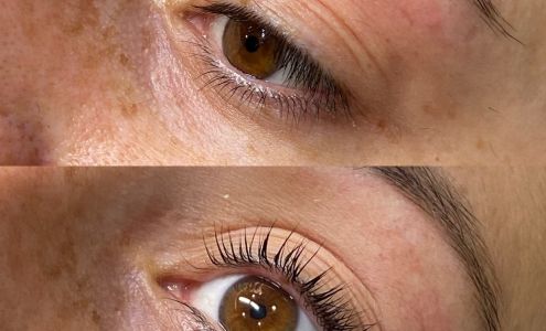 CleanSkin Esthetics 1517A Bayview Ave studio 3, East York Ontario M4G 3B5