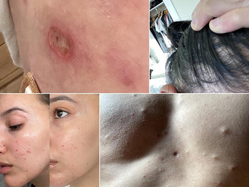 Lavanya Krishnan, MD, Board-Certified Dermatologist