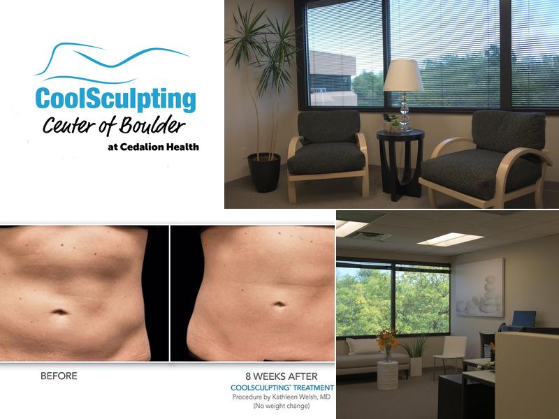 CoolSculpting Center of Boulder