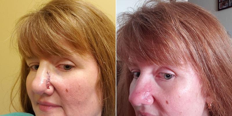 David S. Mezebish M.D.