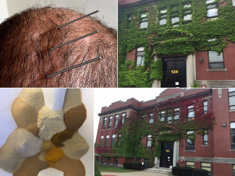 AcuMeD Acupuncture & Herbs