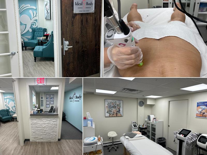 Ideal Body Med Spa