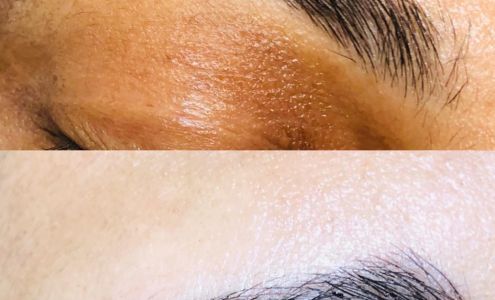 Skinrevite laser clinic