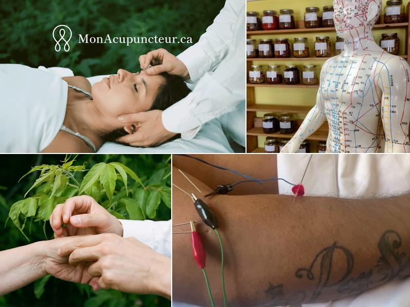 Clinique Mon Acupuncteur - Plateau Mont-Royal - Acupuncture Montréal