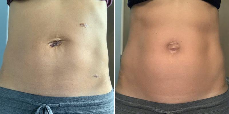 Torrance Spine Institute