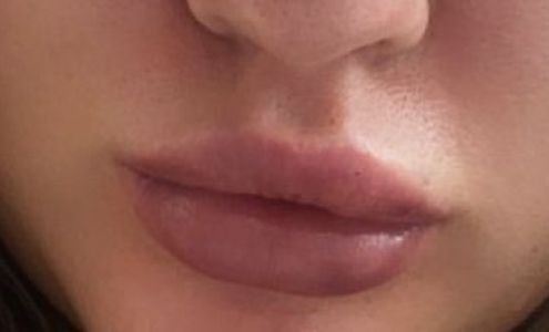 Dr. Faramarz Davidi, MD