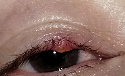 Friedrichs Family Eye Center 32 N Main St, Chatham Virginia 24531