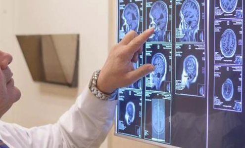 University Neurology: Dr. Joseph Centofanti and Dr. Erica Szabados