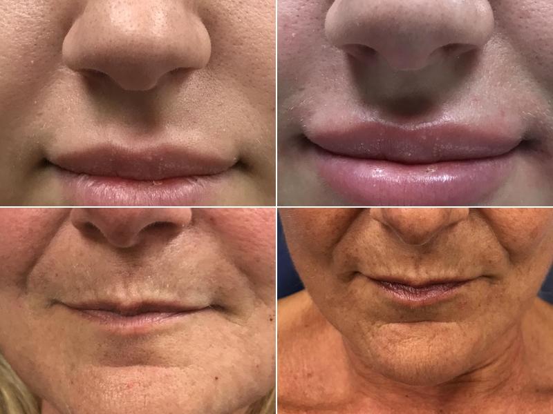 Luxuria Medical Spa & Laser Center Laser Tattoo Removal