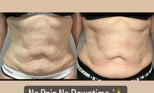 Skin Kneads 132 E 22nd St P1, New York New York 10010