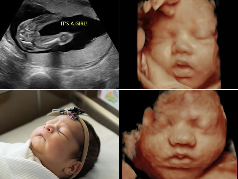 Sentiments 4D Ultrasound Studio LLC