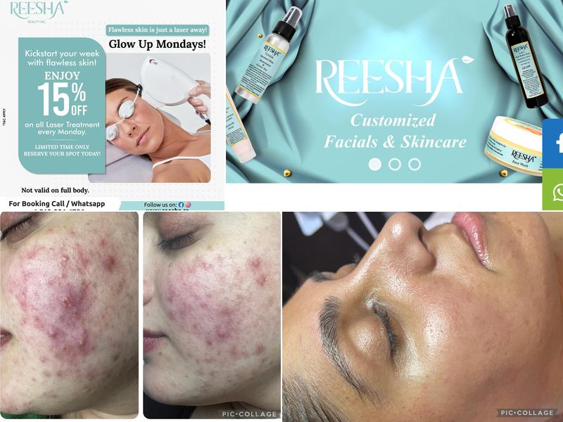 Reesha- Customized Facials & Skincare
