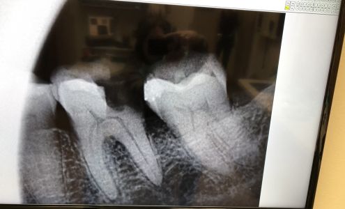 Advanced Dental 489 State Hwy 32, Lebanon Missouri 65536