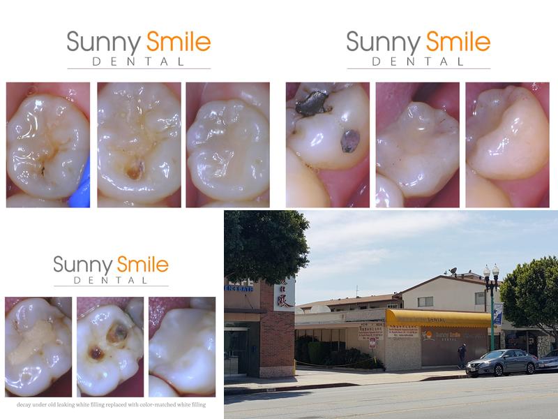 Sunny Smile Dental