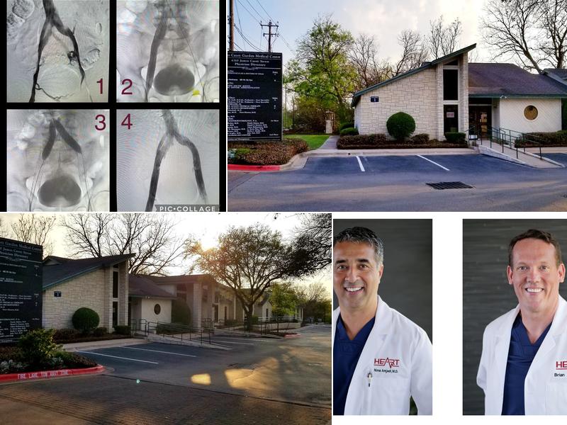 Heart Endovascular and Rhythm of Texas (HEART)