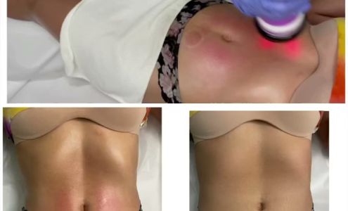 Bodylux 2526 Pecan Blvd, McAllen Texas 78501