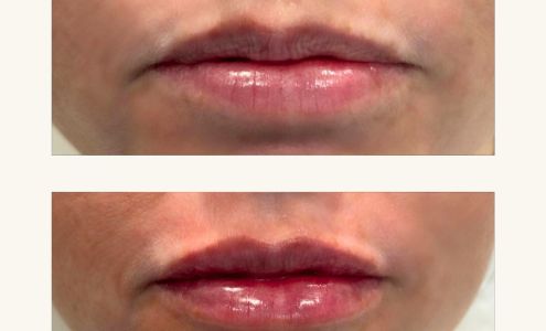 Beverly Hills Wellness Center and Med Spa