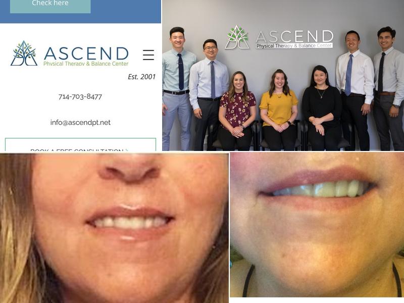 Balance Rehabilitation- Garden Grove Physical Therapy