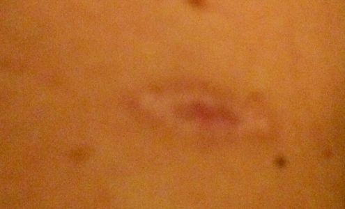 Marcia Glenn Dermatology Center 4644 Lincoln Blvd #500, Marina Del Rey California 90292