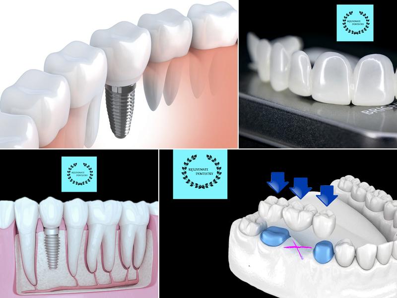 Rejuvenate Dental of Ferndale