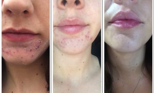 Laser & Skin Care Center of Nevada