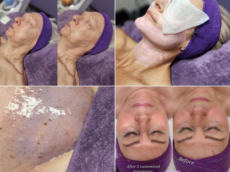 UniqueBeauuty Aesthetics