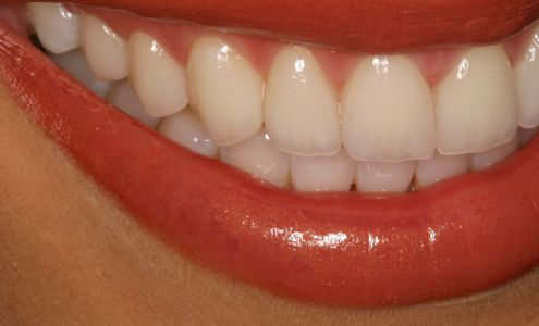 John Lowe DDS Contemporary Dental Concepts 2000 E 116th St, Carmel Indiana 46032