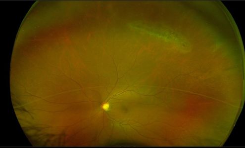 Costco Vision Center