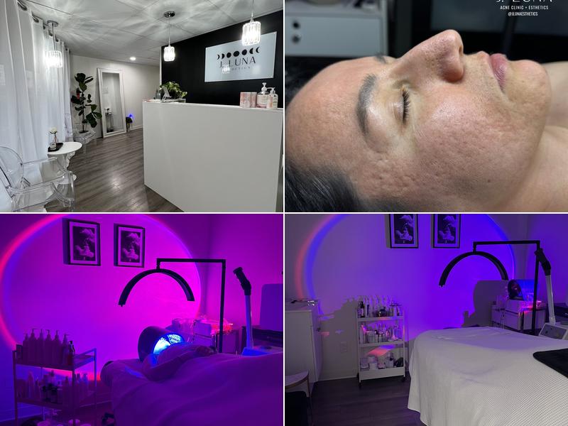 J. Luna Acne Clinic + Esthetics