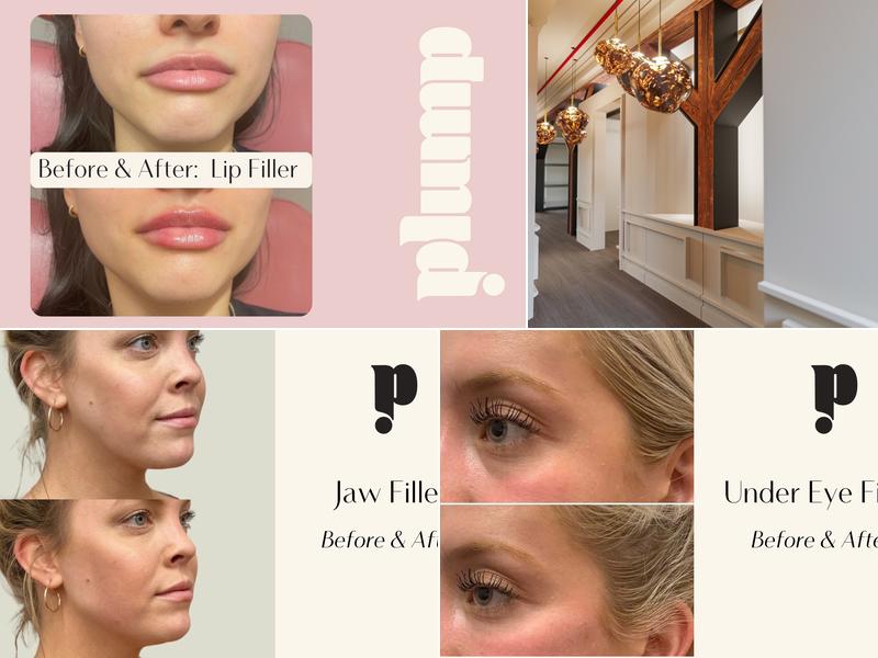 Plump Cosmetics & Injectables
