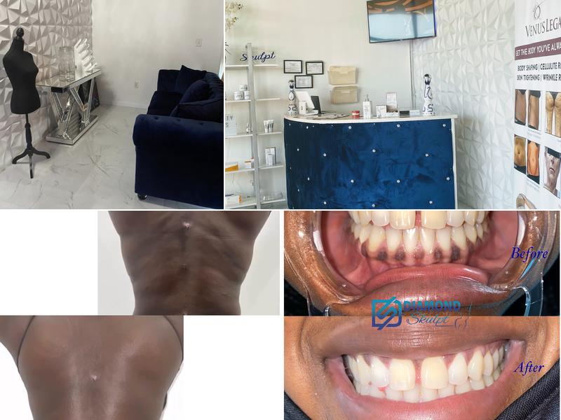 Diamond Skulpt Med Spa