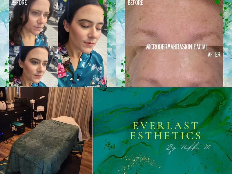 Everlast Esthetics