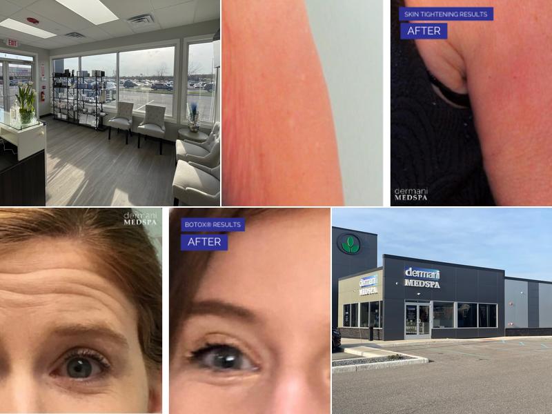 dermani MEDSPA Granger