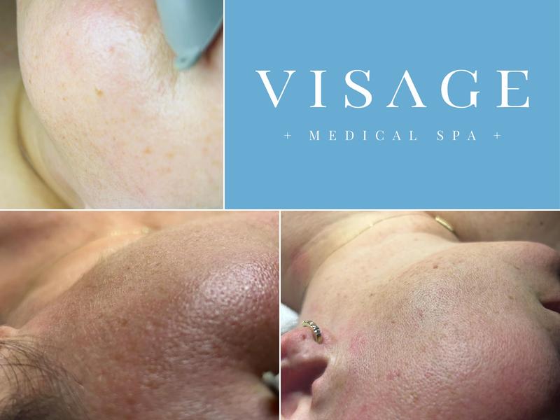 Visage Medical Spa